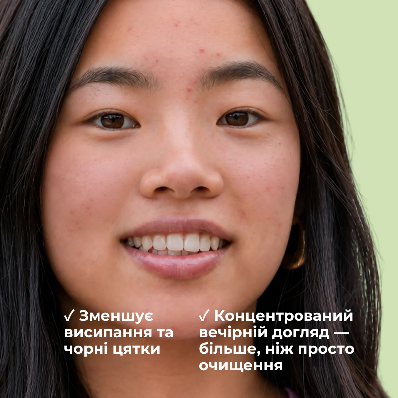 Сыворотка-пилинг для комбинированной и жирной проблемной кожи PERFECT+ ALPHANOVA Thermal Care/2