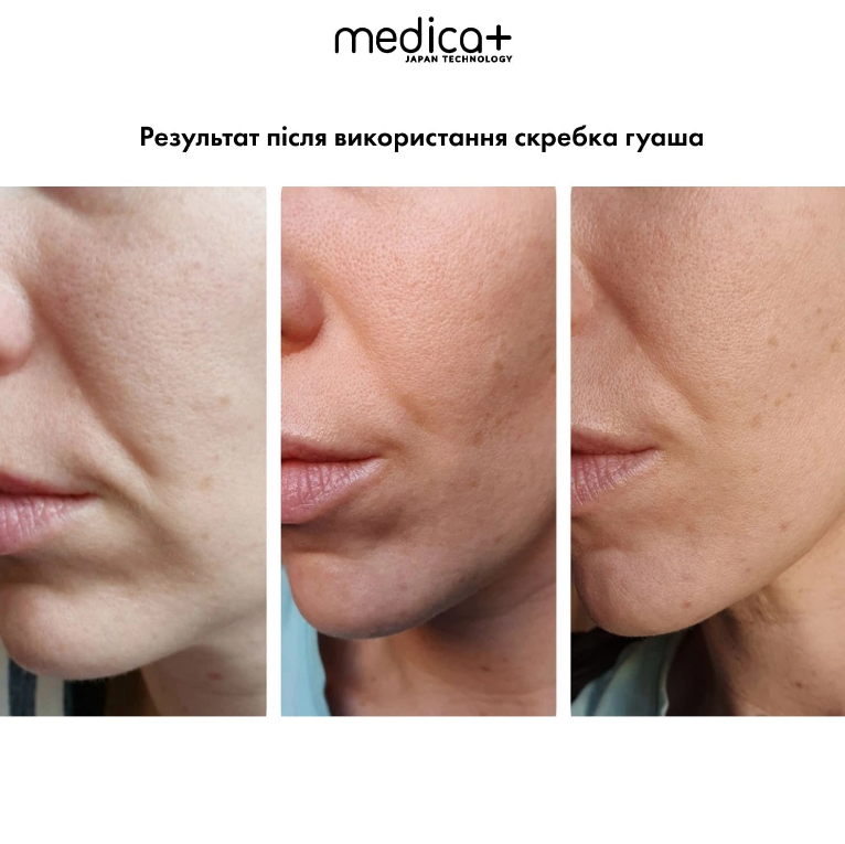 Сталевий скребок гуаша для моделювання овалу обличчя MEDICA+ Steel GuaSha/4