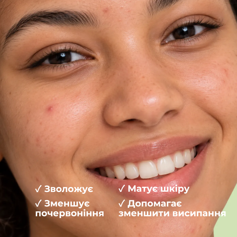 Зволожувальний матуючий крем для жирної та проблемної шкіри PERFECT+ ALPHANOVA Thermal Care/2