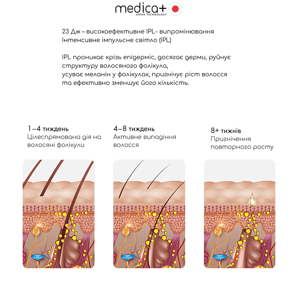 Фотоэпилятор охлаждающий MEDICA+ ICE PRO 10X/7