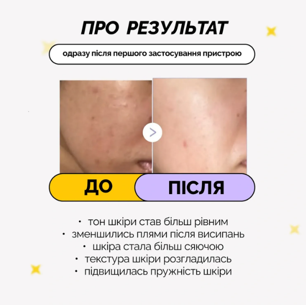 Міні-пристрій для домашнього догляду за шкірою Medicube AGE-R Booster Pro Mini/4