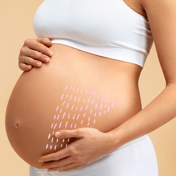 Как ухаживать за телом во время беременности