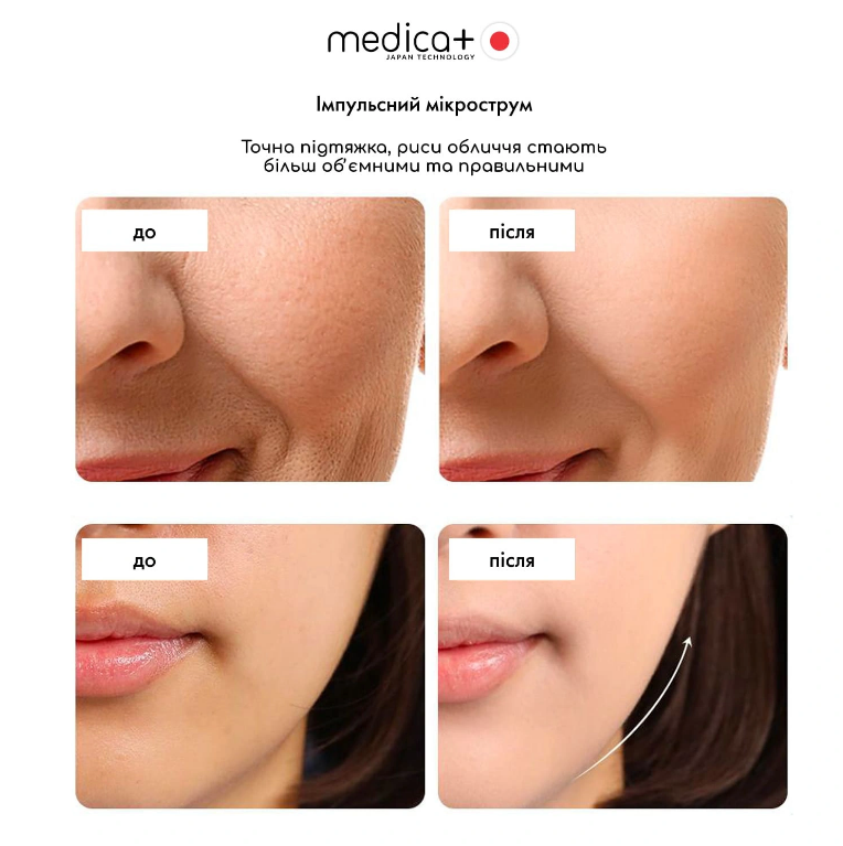 Массажер для лица SkinLifting PRO 10x с микротоками, RF и функцией лифтинга/6